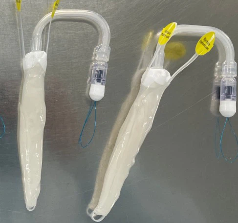 Adjustable Intragastric Balloon Weight Loss Endoscopic Gastric Balloon
